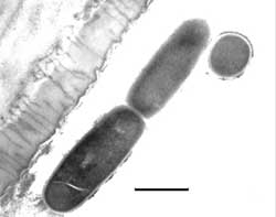 Dividing Bacteria