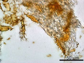 The finding of pliable blood vessels, blood cells and proteins in dinosaur bone is consistent with an age of thousands of years for the fossils, not the 65+ million years claimed by the paleontologists. For more see Dino soft tissue find—a stunning rebuttal of ‘millions of years’