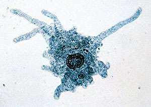 An amoeba