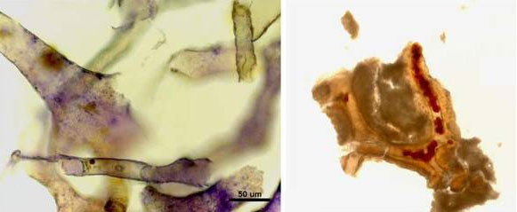 The finding of pliable blood vessels, blood cells and proteins in dinosaur bone is consistent with an age of thousands of years for the fossils, not the 65+ million years claimed by the paleontologists. For more see Dino soft tissue find—a stunning rebuttal of ‘millions of years’