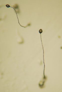 Figure 1. Multicellular fruiting bodies of Dictyostelium discoideum. 