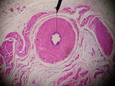 Vas deferens - creation.com diagram of ureter slide 