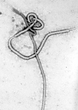 Ebola-virus