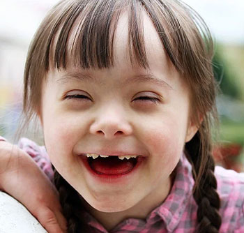 down-syndrome-child